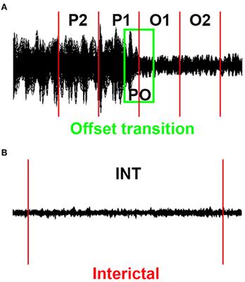 Dynamic Neuromagnetic Network Changes of Seizure Termination in Absence Epilepsy: A Magnetoencephalography Study